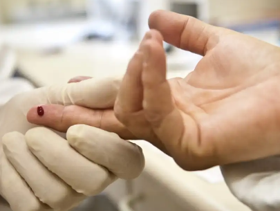 CASOS DE SÍFILIS E DE HIV/AIDS AUMENTAM ENTRE HOMENS JOVENS